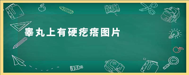 睾丸上有硬疙瘩图片