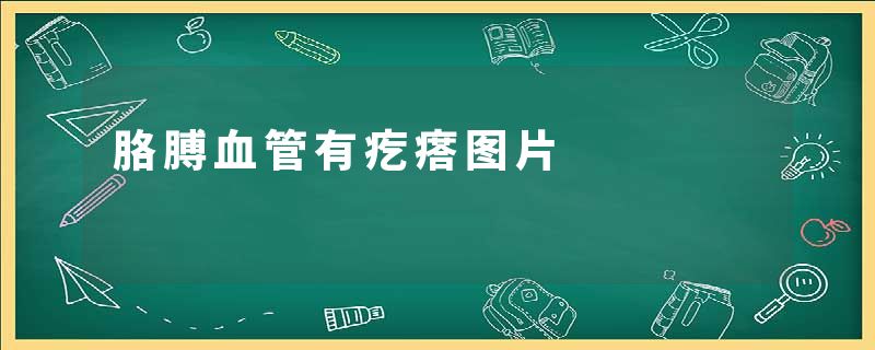 胳膊血管有疙瘩图片