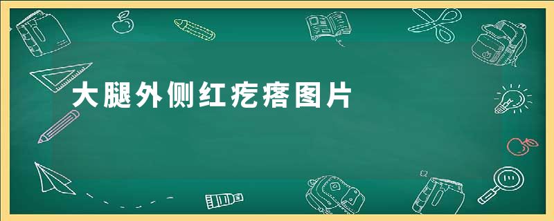 大腿外侧红疙瘩图片