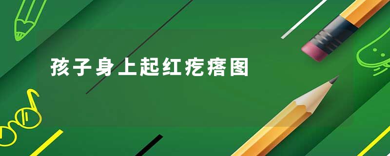 孩子身上起红疙瘩图