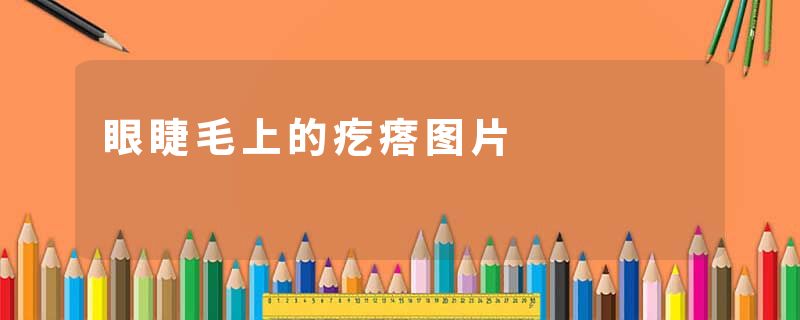眼睫毛上的疙瘩图片