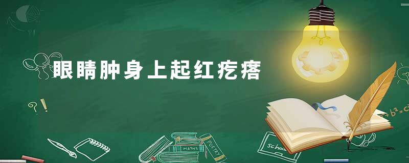 眼睛肿身上起红疙瘩
