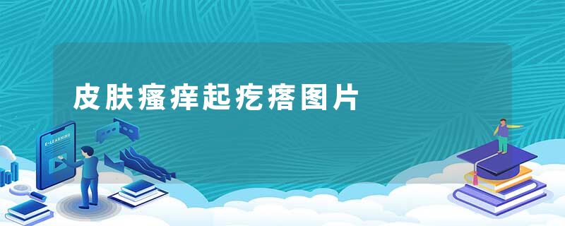 皮肤瘙痒起疙瘩图片