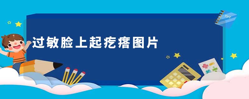 过敏脸上起疙瘩图片