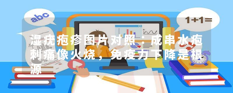 湿疣疱疹图片对照：成串水疱刺痛像火烧，免疫力下降是根源
